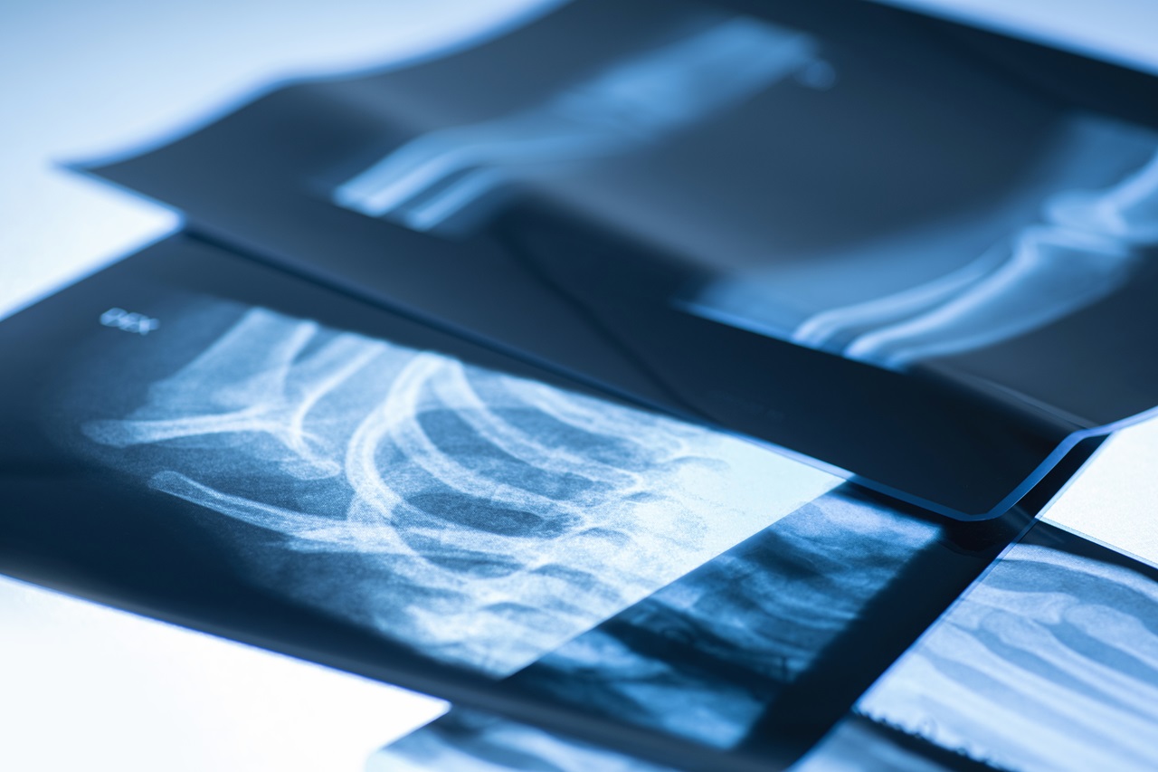 Diagnostic X-Ray Imaging