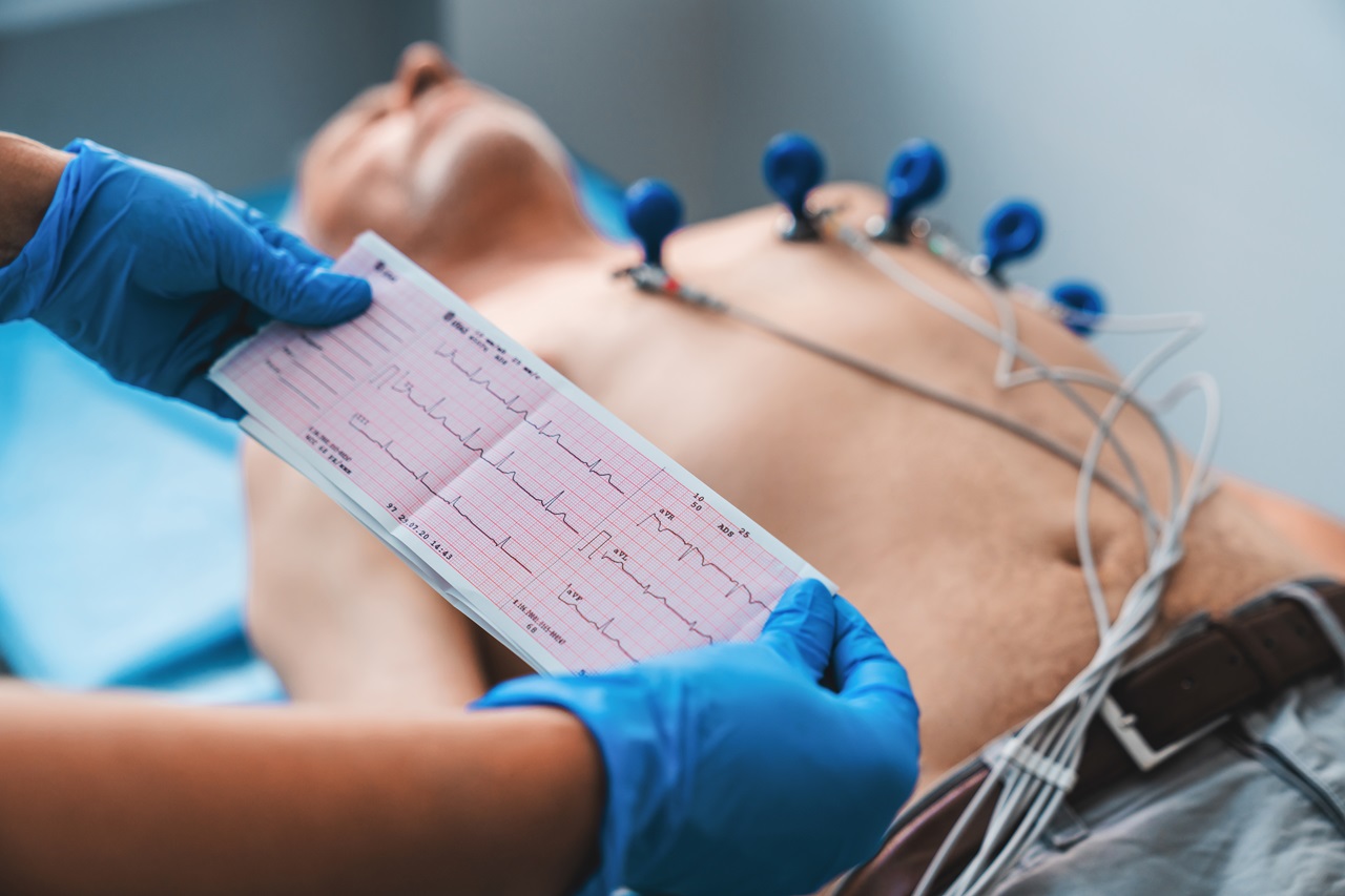 EKG Testing and Heart Monitoring