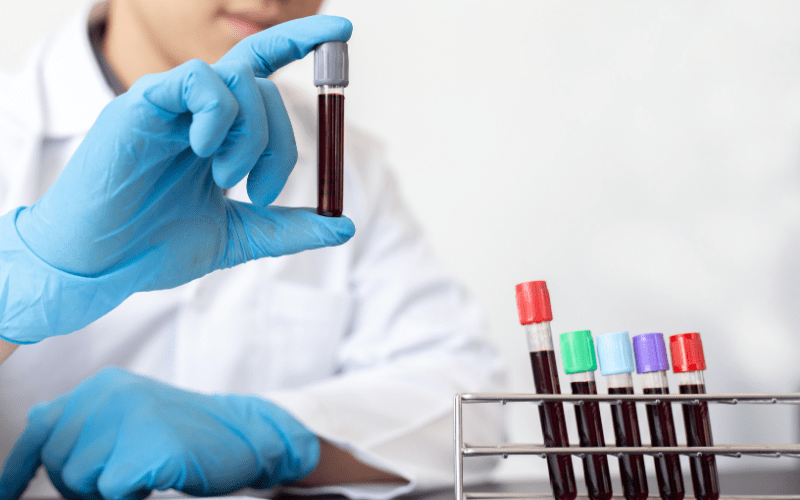 Confidential STD Testing Services