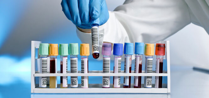 On-site laboratory services